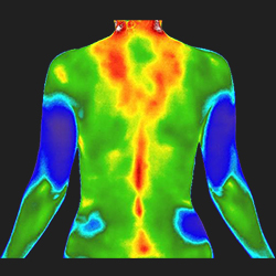 Thermography - Upper Body Back 250px